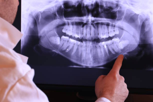 Best Emergency Dental Surgery in Crookston, MN